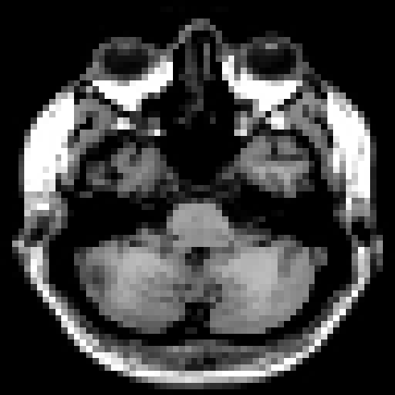 \includegraphics[width=1.0\textwidth]{mri_ex}